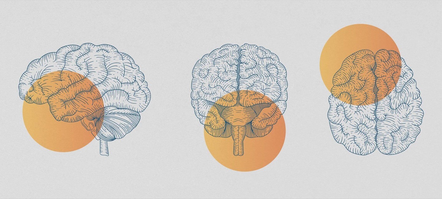 IHC21_One pager_NPS-TPE-NP-00442_Header_1150x500px_150ppi.jpg Illustration of three brains surmounted by three orange dots.
