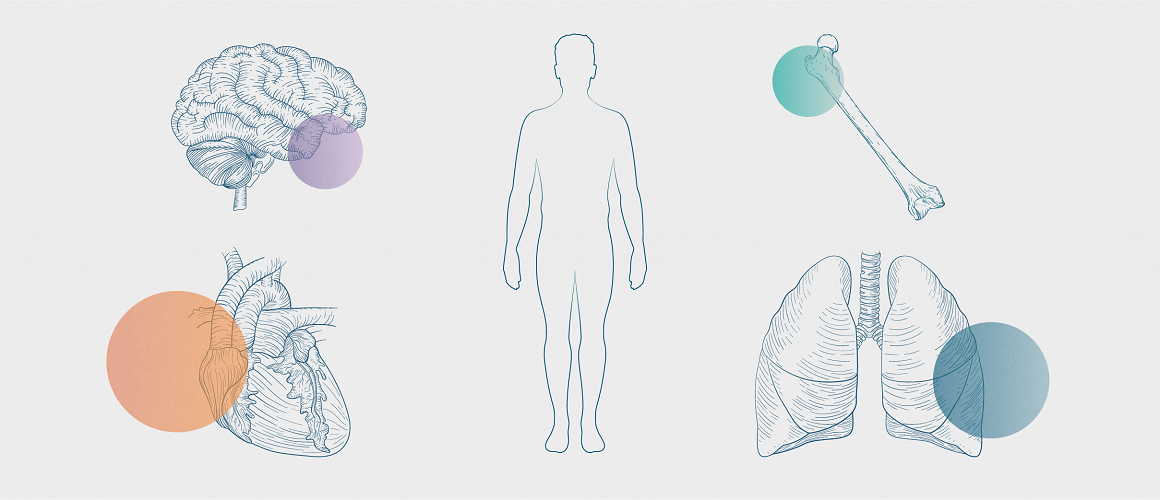 Migraine_and_comorbidities_1160x500r.png Silhouette of human body surrounded by percentages representing the prevalence of comorbid conditions among chronic migraine patients.10,11