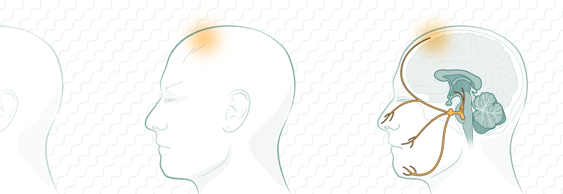 Modern_Understanding_of_the_Pathophysiolog_of_Migraine_1160x400.png Modern_Understanding_of_the_Pathophysiolog_of_Migraine_1160x400.png